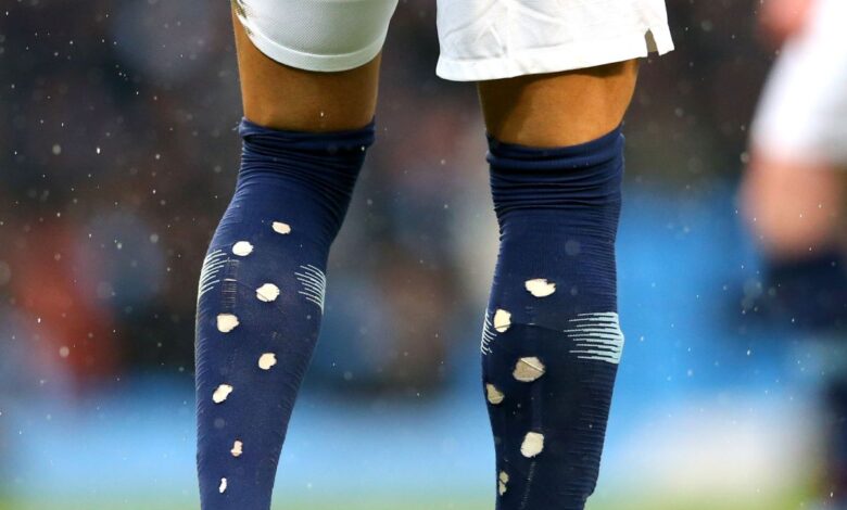 Mengapa pesepak bola ketika ini melubangi kaus kakinya? Hal ini alasannya